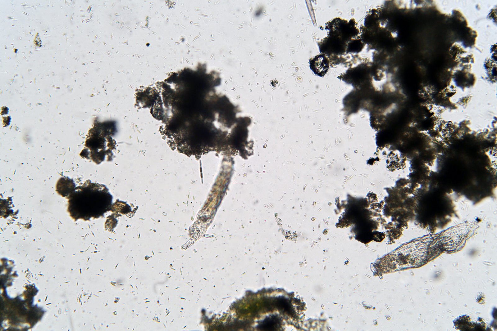 Microscopic image showing various microorganisms and organic debris in a clear background.